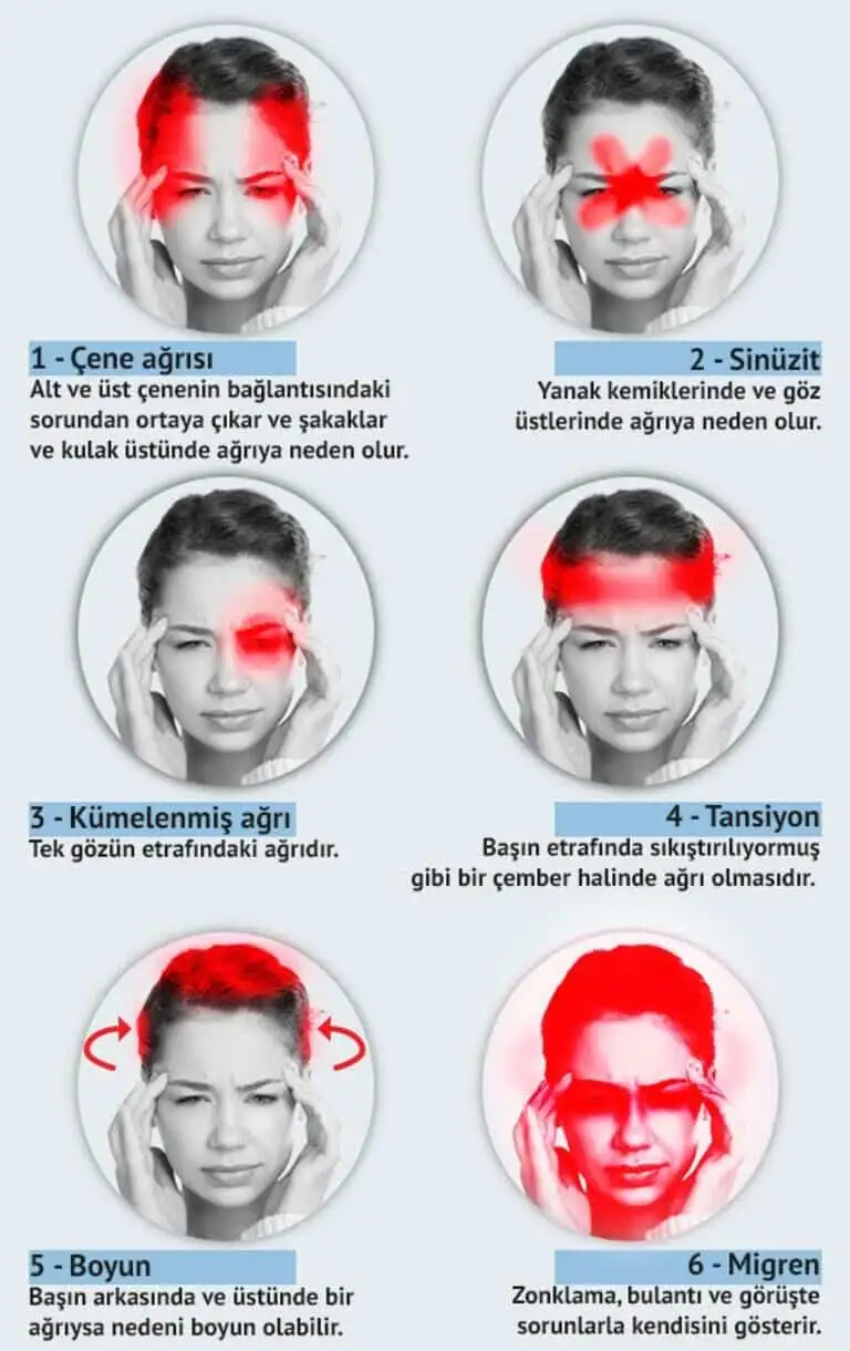Baş Ağrısı Türleri Ve Belirtileri