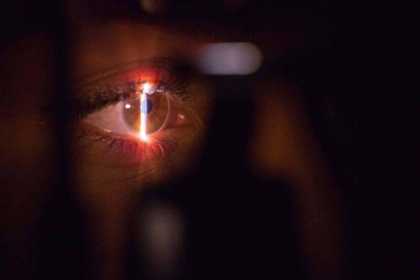 Lazer Göz Ameliyatı Nasıl Yapılır?