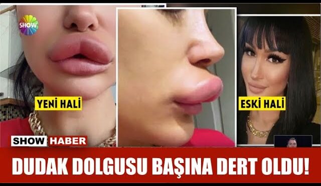 img-038ef23ef046d703f0d9ed981d500fe2