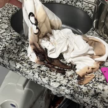 lavabo_acici_kullanimi