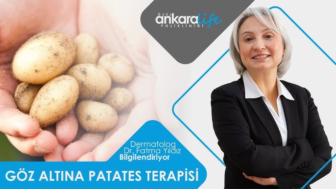 göz_altı_morlukları_için_patates_maskesi