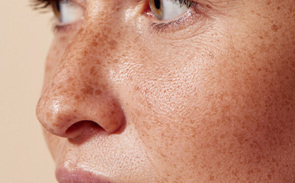 img-3a428e6393e0eb6d2422d5ba1d9a7047