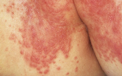 img-4a5faf1486ecc372f1611b4b5eb798a2