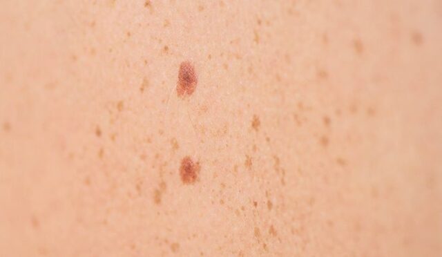 img-9e435b1ab4ecc2cac18c5e52ab1f8aa0