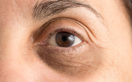 img-aaea47c53486f0c861f75c0000687c3a