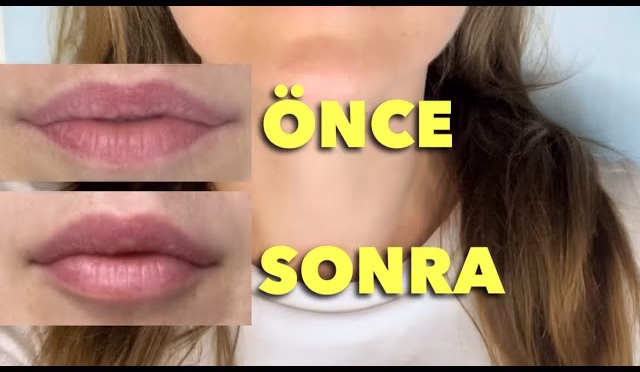 img-efb4a227a66204dea192aec02ecd7aec